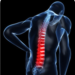 La spondilite anchilosante oggi: reumatologi e radiologi a confronto