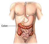 Valutazione e gestione medico/chirurgica della malattia diverticolare del colon