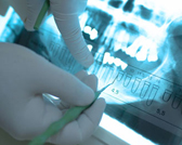 Nuove acquisizioni scientifiche nella pratica professionale dell’implantologia